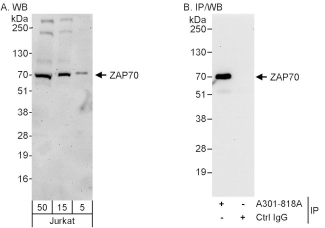 ZAP70 Antibody in Western Blot (WB)