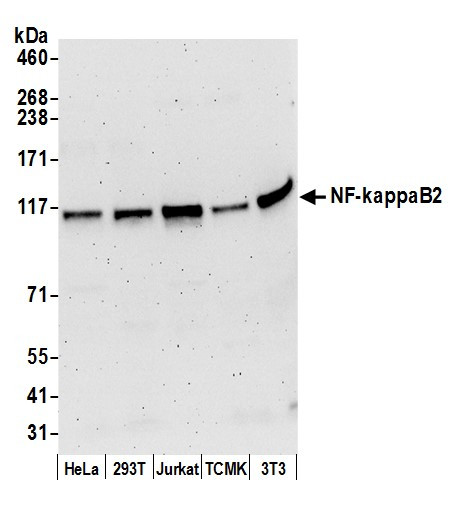 NF-kappaB2 Antibody in Western Blot (WB)