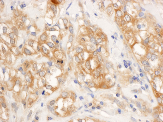 RelA Antibody in Immunohistochemistry (Paraffin) (IHC (P))