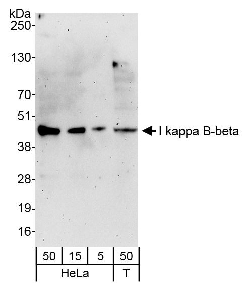 I kappa B-beta Antibody in Western Blot (WB)