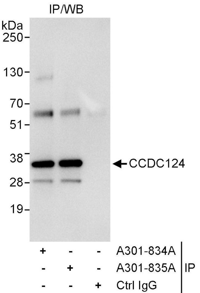 CCDC124 Antibody in Immunoprecipitation (IP)