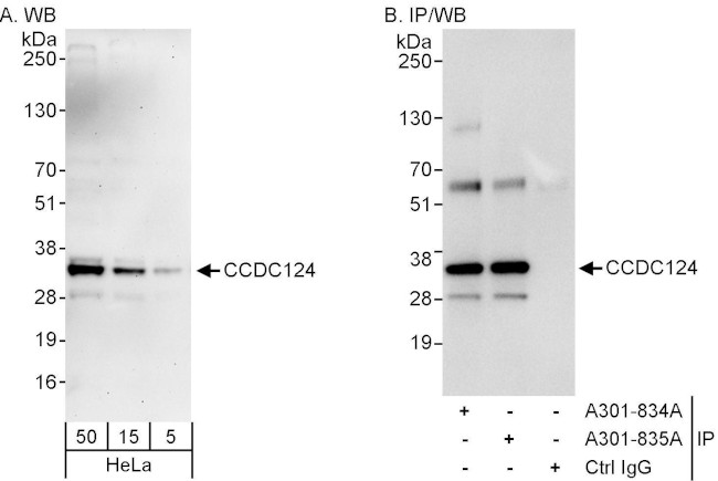 CCDC124 Antibody in Western Blot (WB)