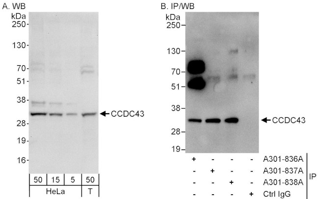 CCDC43 Antibody in Western Blot (WB)