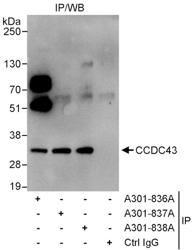 CCDC43 Antibody in Immunoprecipitation (IP)