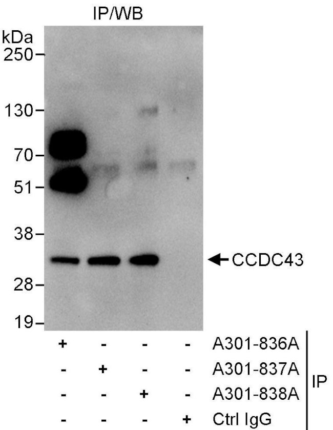 CCDC43 Antibody in Immunoprecipitation (IP)