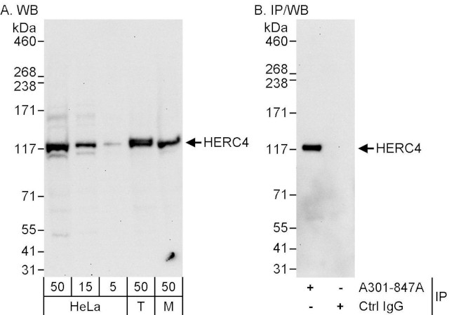 HERC4 Antibody in Western Blot (WB)