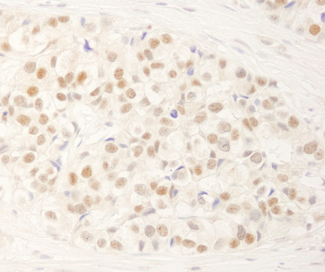 NRBF2 Antibody in Immunohistochemistry (Paraffin) (IHC (P))