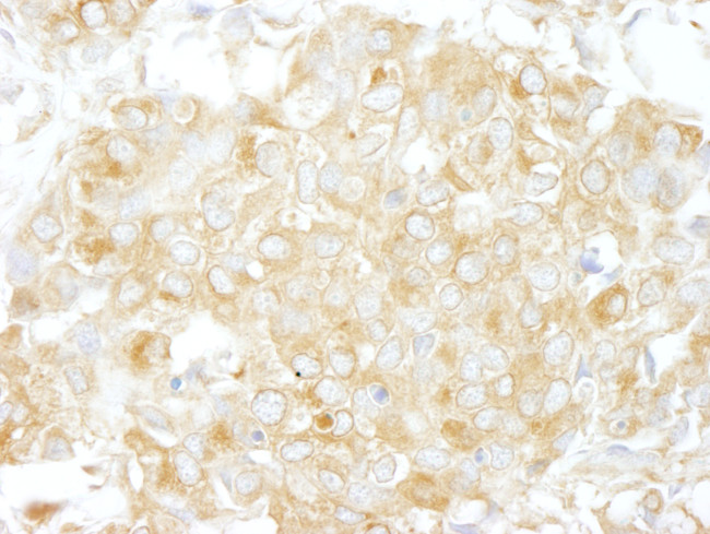 Cdc42GAP Antibody in Immunohistochemistry (Paraffin) (IHC (P))