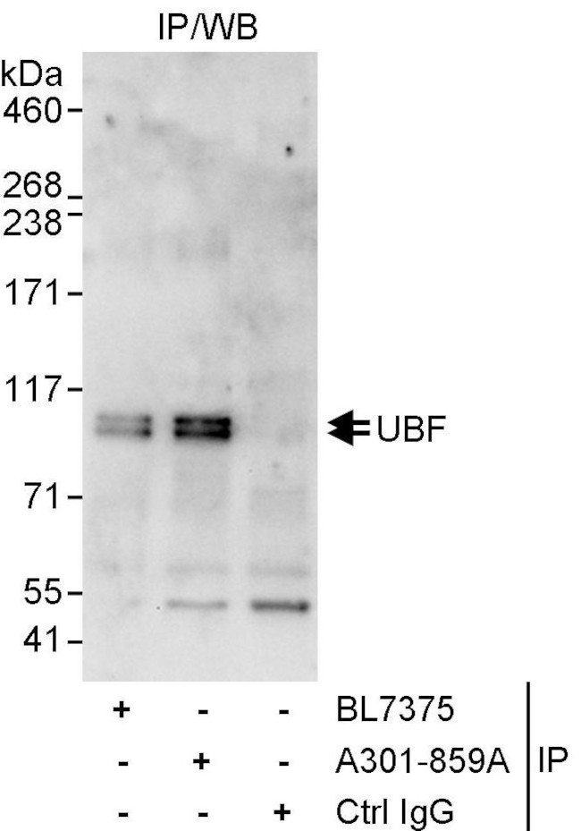 UBF Antibody in Immunoprecipitation (IP)
