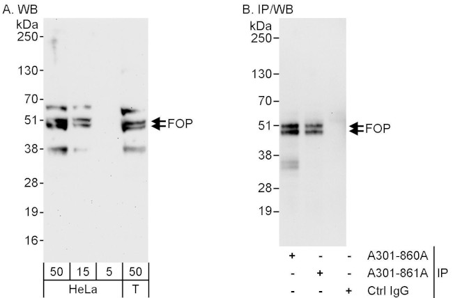 FOP Antibody in Western Blot (WB)