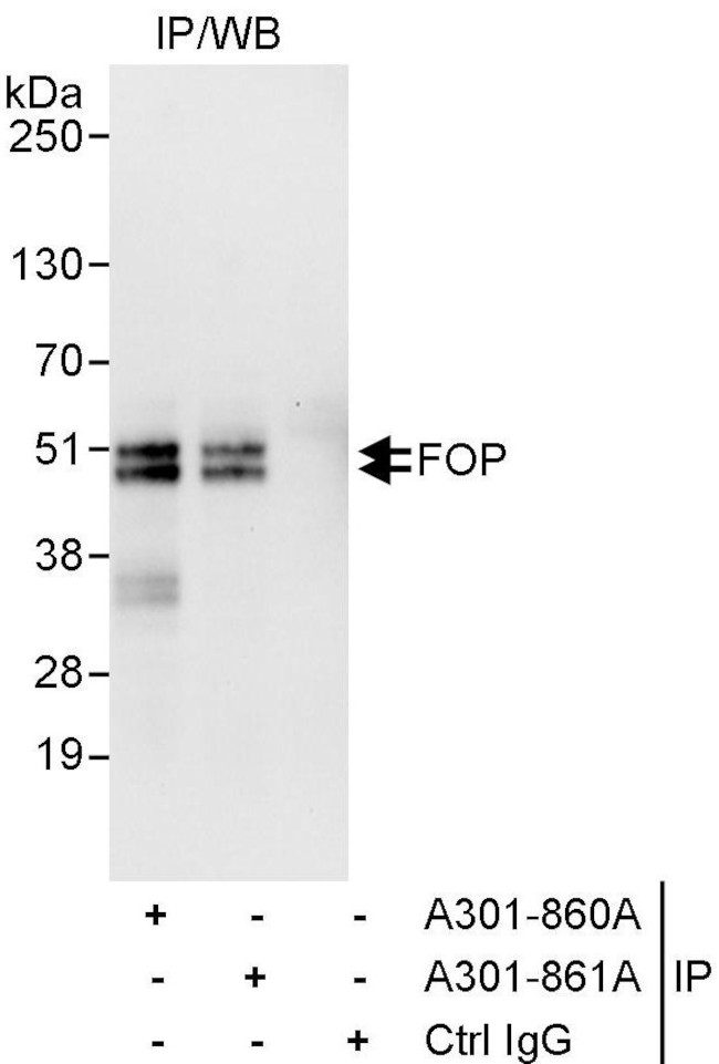 FOP Antibody in Immunoprecipitation (IP)