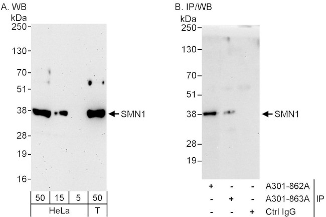 SMN1 Antibody in Western Blot (WB)