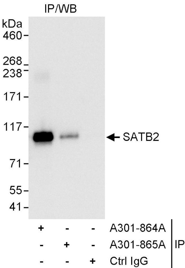SATB2 Antibody in Immunoprecipitation (IP)