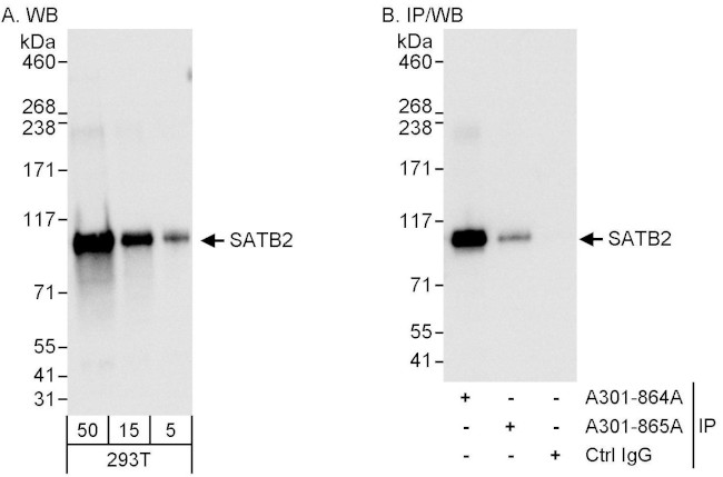 SATB2 Antibody in Western Blot (WB)