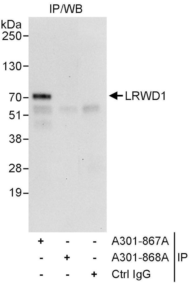 LRWD1 Antibody in Immunoprecipitation (IP)