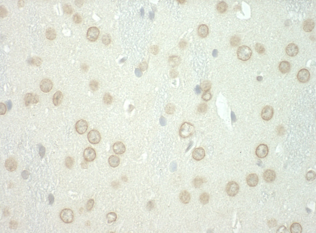 WDFY3 Antibody in Immunohistochemistry (Paraffin) (IHC (P))