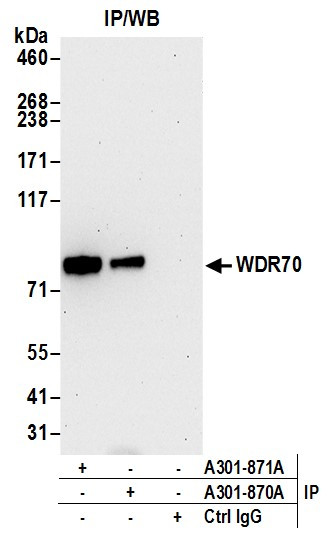 WDR70 Antibody in Immunoprecipitation (IP)