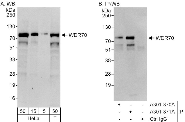 WDR70 Antibody in Western Blot (WB)