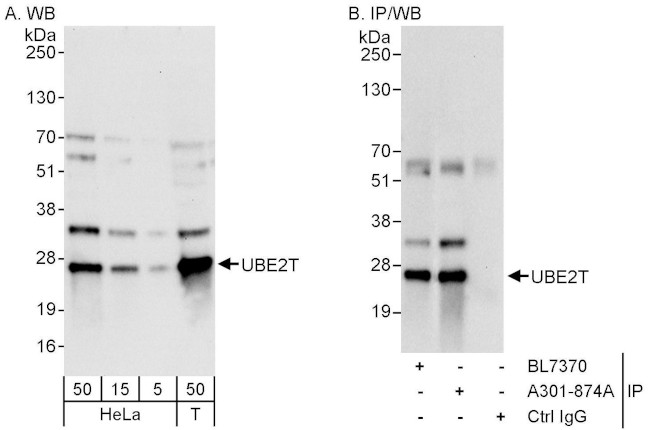 UBE2T Antibody in Western Blot (WB)