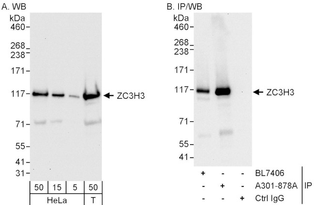 ZC3H3 Antibody in Western Blot (WB)