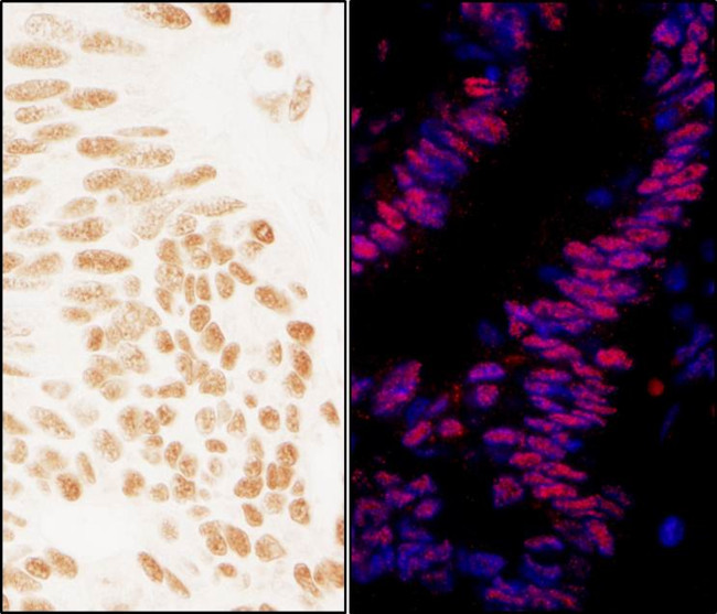 ZNF326 Antibody in Immunohistochemistry (Paraffin) (IHC (P))