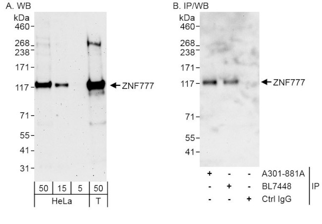 ZNF777 Antibody in Western Blot (WB)