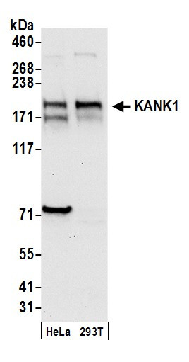 KANK1 Antibody in Western Blot (WB)