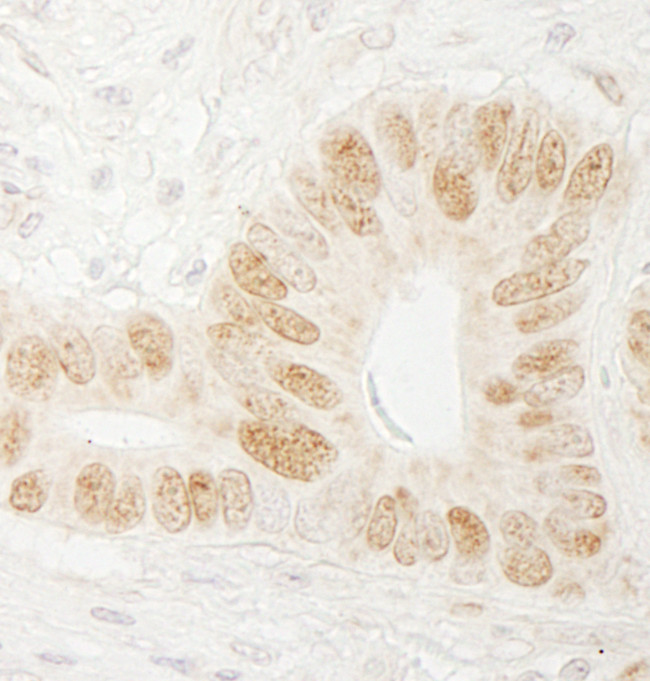 CTF18 Antibody in Immunohistochemistry (Paraffin) (IHC (P))