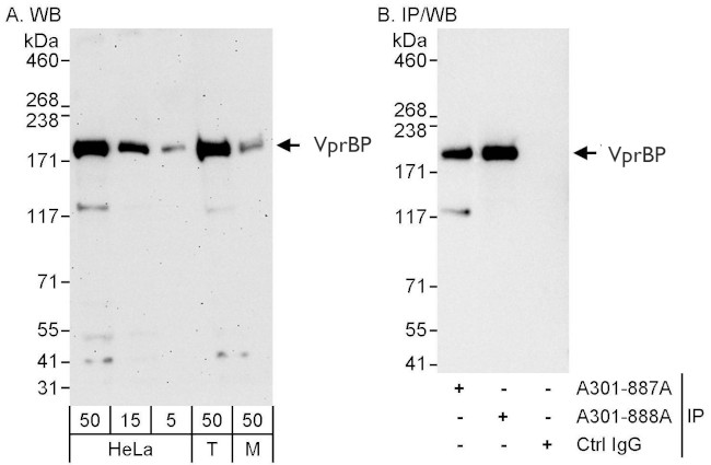 VprBP Antibody in Western Blot (WB)