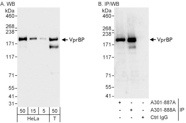 VprBP Antibody in Western Blot (WB)