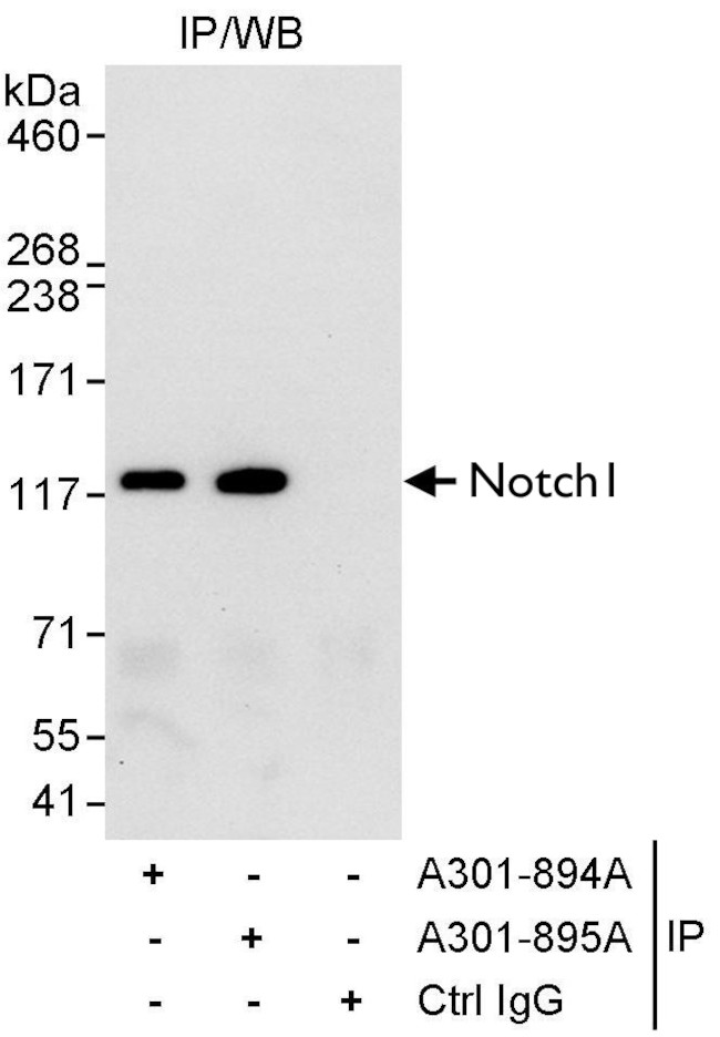 Notch1 Antibody in Immunoprecipitation (IP)