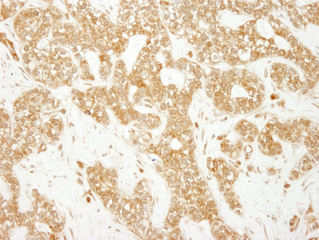 EEA1 Antibody in Immunohistochemistry (Paraffin) (IHC (P))