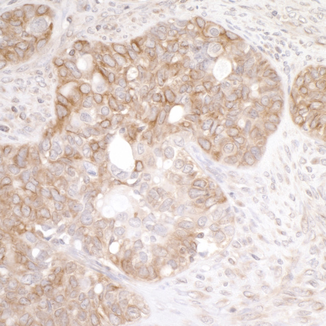 EML4 Antibody in Immunohistochemistry (Paraffin) (IHC (P))