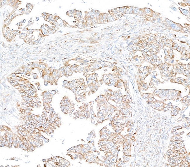 EML4 Antibody in Immunohistochemistry (Paraffin) (IHC (P))