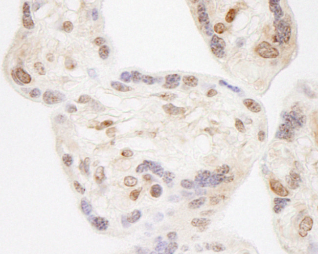 NELFA Antibody in Immunohistochemistry (Paraffin) (IHC (P))
