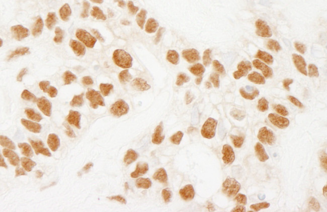NELFE Antibody in Immunohistochemistry (Paraffin) (IHC (P))