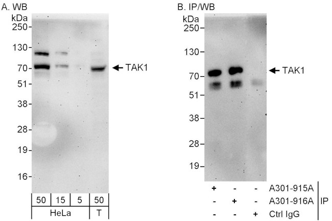 TAK1 Antibody in Western Blot (WB)