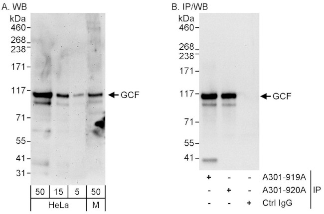 GCF Antibody in Western Blot (WB)