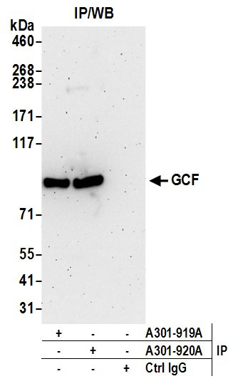 GCF Antibody in Immunoprecipitation (IP)