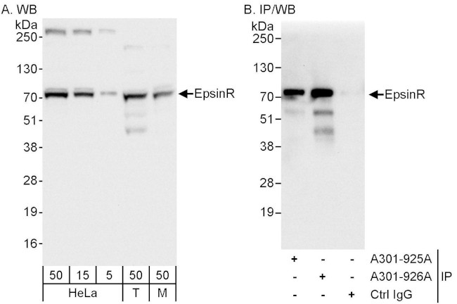 EpsinR Antibody in Western Blot (WB)
