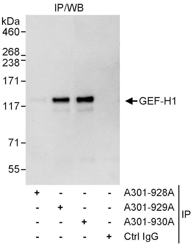 GEF-H1 Antibody in Immunoprecipitation (IP)