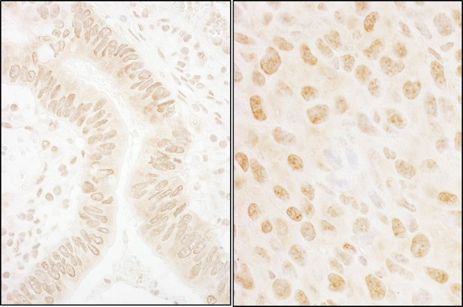 SSB1 Antibody in Immunohistochemistry (Paraffin) (IHC (P))