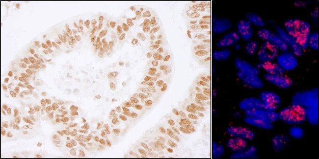 PLRG1 Antibody in Immunohistochemistry (Paraffin) (IHC (P))