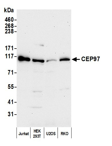 CEP97 Antibody in Western Blot (WB)