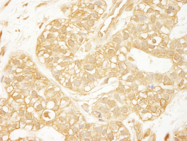 PDZ-RhoGEF Antibody in Immunohistochemistry (Paraffin) (IHC (P))