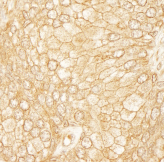 PDZ-RhoGEF Antibody in Immunohistochemistry (Paraffin) (IHC (P))