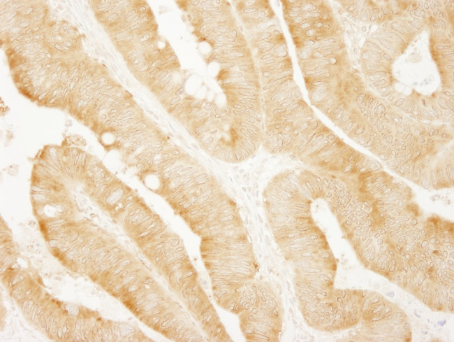 vPARP Antibody in Immunohistochemistry (Paraffin) (IHC (P))