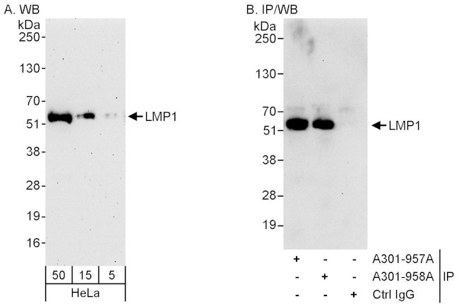 LMP1 Antibody in Western Blot (WB)