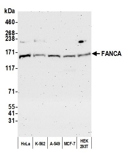 FANCA Antibody in Western Blot (WB)