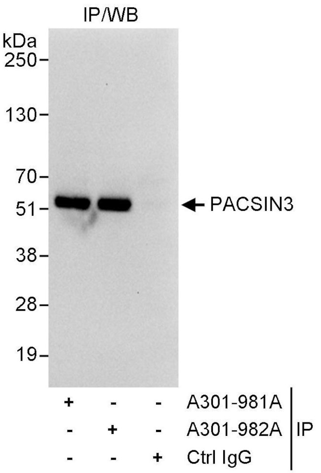 PACSIN3 Antibody in Immunoprecipitation (IP)